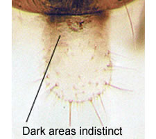 Elipsocus abdominalis